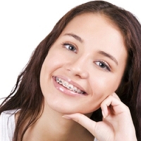 Не имеющая аналогов в мире технология Flash-Free защитит зубную эмаль при ортодонтическом лечении.