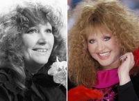 Алла Пугачева. Зубы