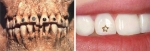 Зубы народа Майя и современные скайсы